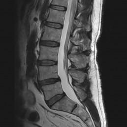 Diagnostic MRI image